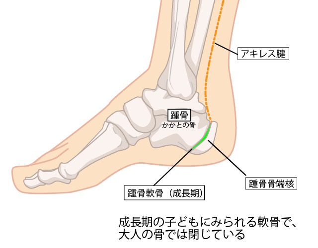 アキレス腱とは?